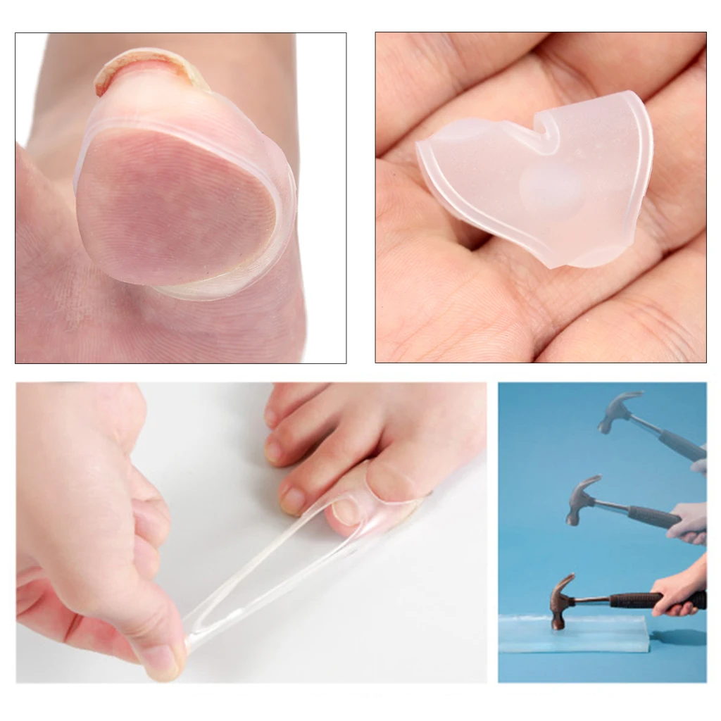 

Clear Ingrown Toe Nail Repair Correction Corrector Sleeves Paronychia Tool