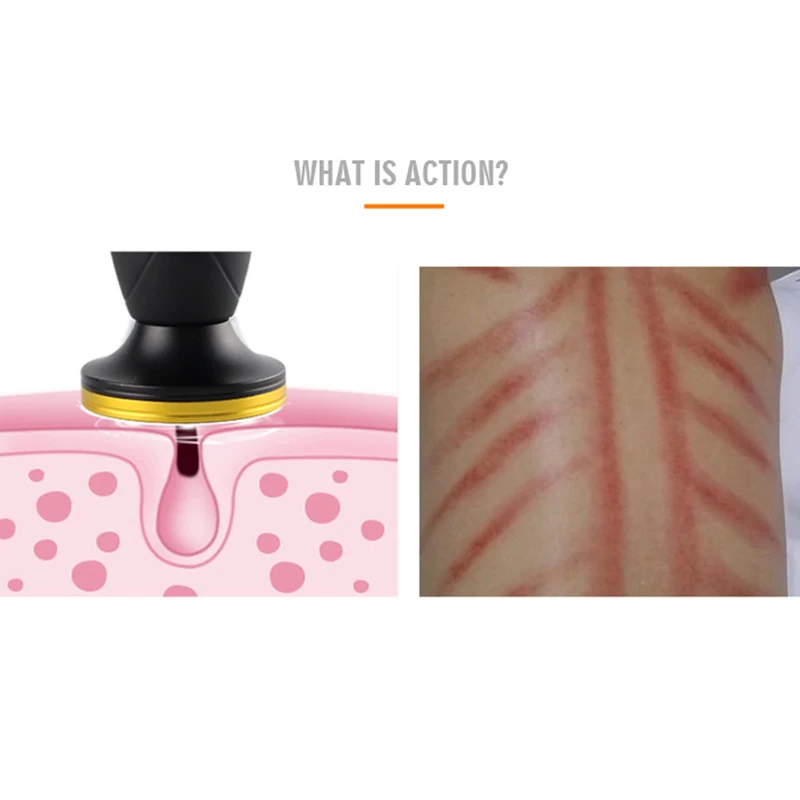 

Electric Body Massage Lymph Detox Gua Sha Meridian Dredge Guasha Negative Pressure Massage Scraping Machine Health Care