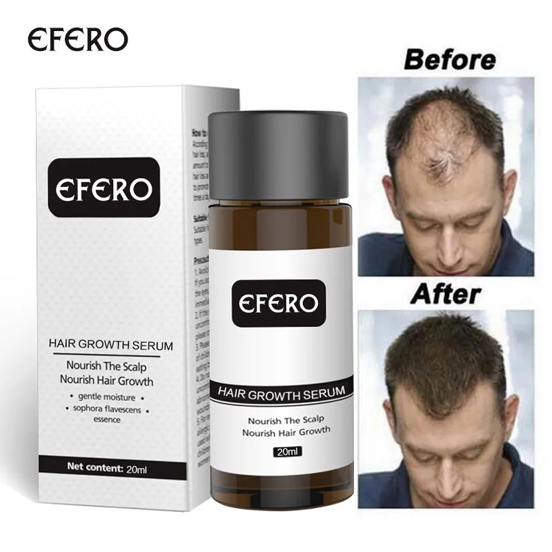 

EFERO Fast Powerful Hair Growth Oil Hair Loss Products Essential Oil Regrow Dense Hair Restoration Growing Serum Hair Care 20ml