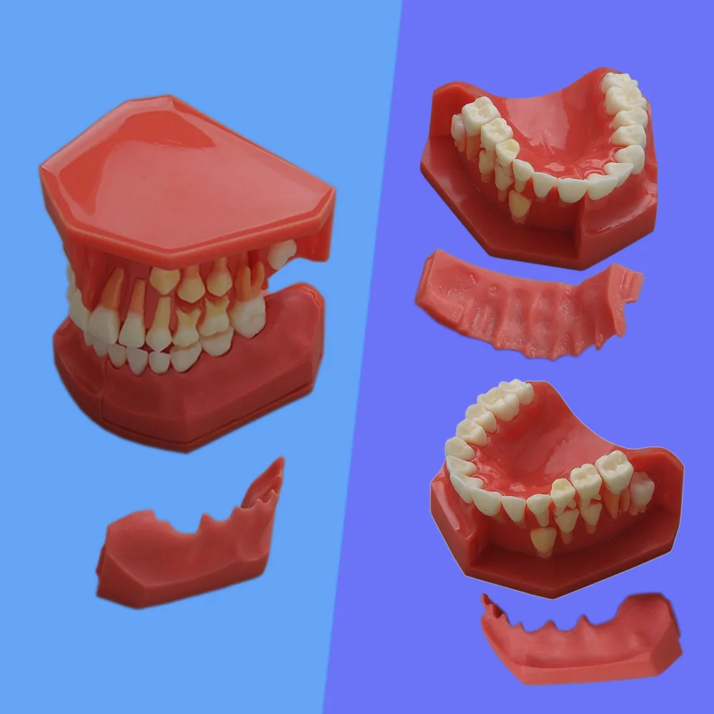 1 Piece Teeth Model Children Deciduous Teeth & Permanent Teeth Changing Model