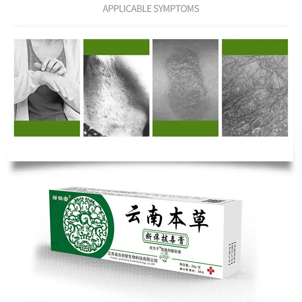 

1Pcs Skin Itching Cream Dermatitis Anti Bacteria Ointment Reilef Dermatitis Treatment Eczematoid Psoriasis Eczema Pruritus