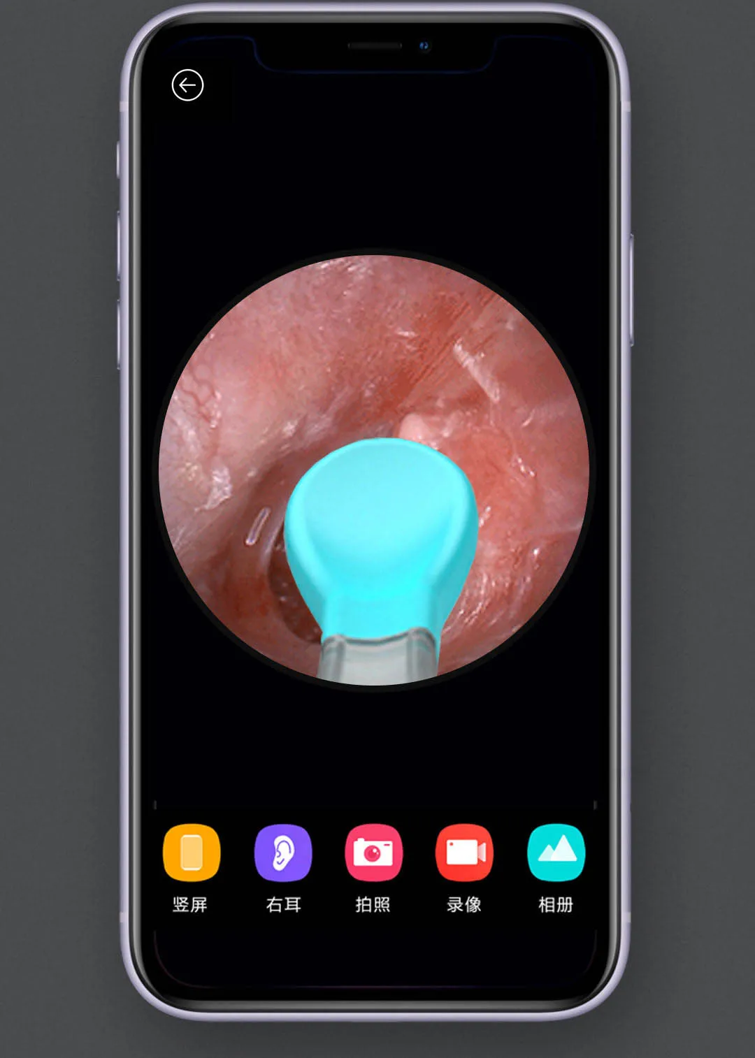 Xiaomi bebird эндоскоп для очистки ушей, визуальная Ушная ложка 3,5 мм 300 Вт, мини-камера, ушной отоскоп, Бороскоп, набор инструментов для ушей