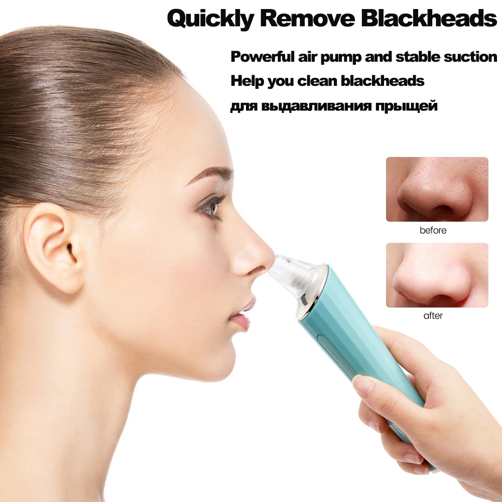 

Blackhead Remover Face Deep Nose Cleaner T Zone Pore Acne Pimple Removal Vacuum Suction Facial Diamond Beauty Clean Skin Tools