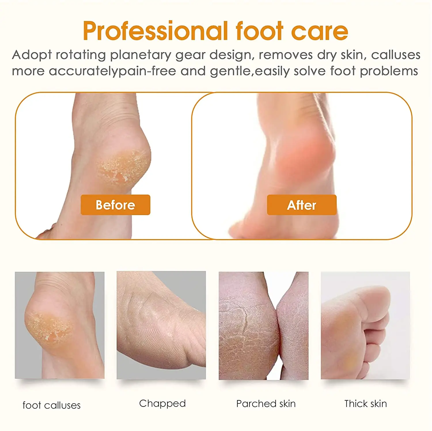 

Electric Pedicure Tools Foot Care File Leg Heels Remove Hard Cracked Dead Skin Remover Feet Clean Care Machine LED display