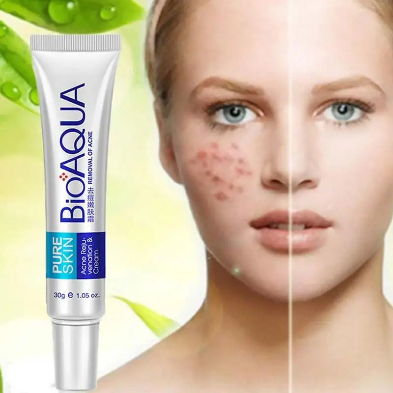30g Acne Cream To Remove Acne Hydrating Acne Cream Oil Nourishing Care V5G5