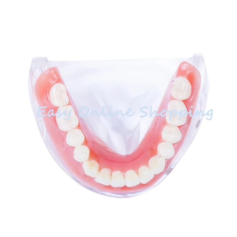 LOSUNCARE 1 шт. модель зубного протеза съемный внутренний мандибуляр с 4 имплантатами