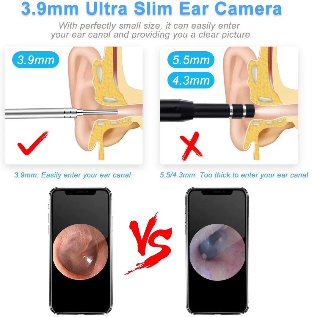 Отоскоп 3 IN Ear 9 мм HD 1080P эндоскоп для чистки ушей камера осмотра инструмент