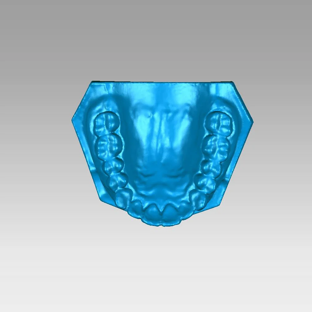 KS 3d Scanner 3D Photogrammetry DIY Kit scanning Dental teeth model . |