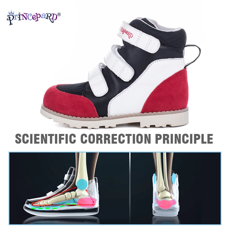 Princepard новая ортопедическая обувь для детей счетчик последний подходит для инверсии стопы eversion x-образные ноги o-ноги