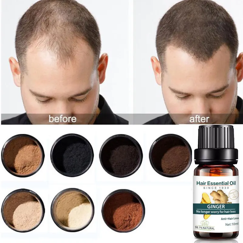 

10 мл имбирное эфирное масло против выпадения волос, флюид для волос, чистый натуральный неразбавленный Уход за волосами, утолщенные волосы