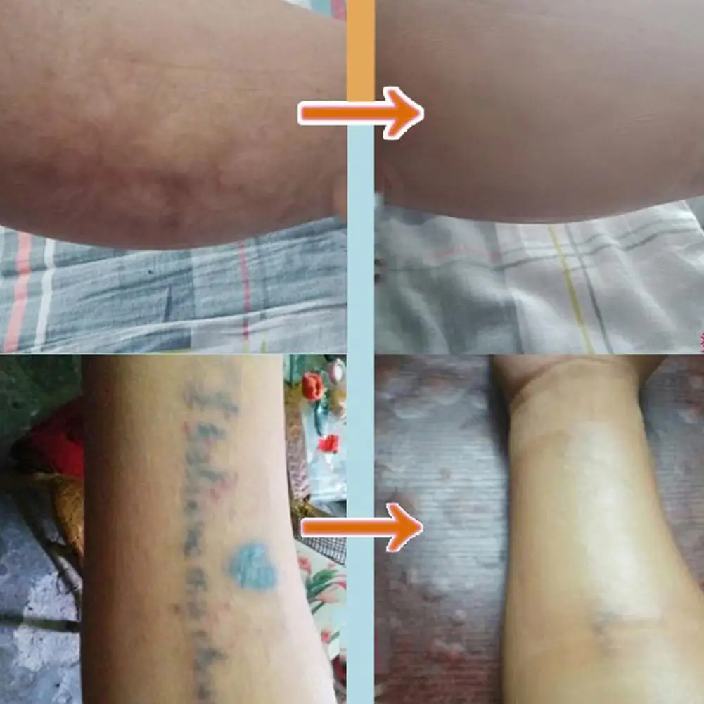 1 шт. одноразовая лента для татуировки шрамы маскирующая защитное покрытие кожи