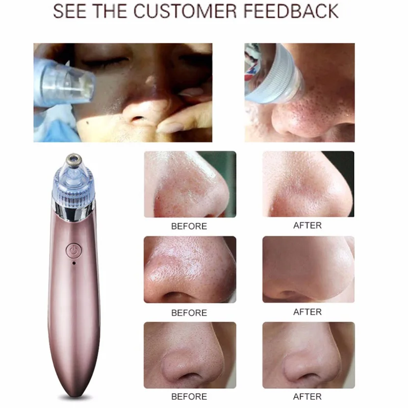 Электрический мини Ручной вакуумный отсос угрей для удаления омоложения кожи