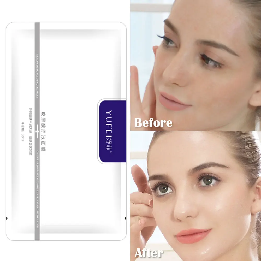 【YUFIEI】Hyaluronic Acid Facial Mask Moisturizing Lock Water Improves Dry Skin Inhibit Melanin Restore Elasticity Anti-Aging | Красота и