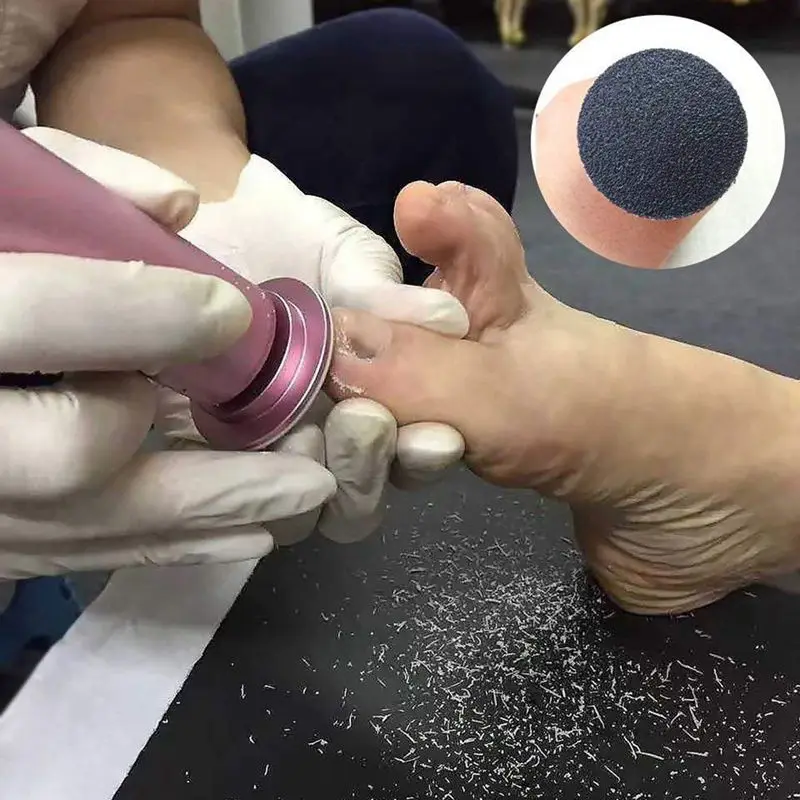 60 шт. Сменные шлифовальные диски диск для Электрические роликовые пилки стоп