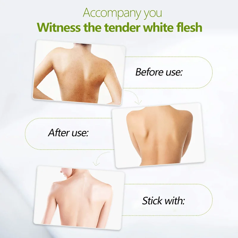 WXE 100% натуральные фруктовые кислоты лосьоны крем отбеливающий сильный