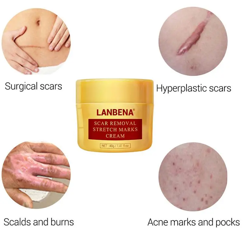 

LANBENA Acne Scar Removal Cream Gel Treatment Acne Pimples Stretch Marks Smoothing Whitening Moisturizing Body Serum Skin Care