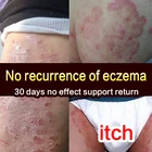 Натуральный травяной крем от псориаза для тела, лекарственное средство против мазь против зуда ухода, эффективный крем против грибка, зуда, уход за кожей