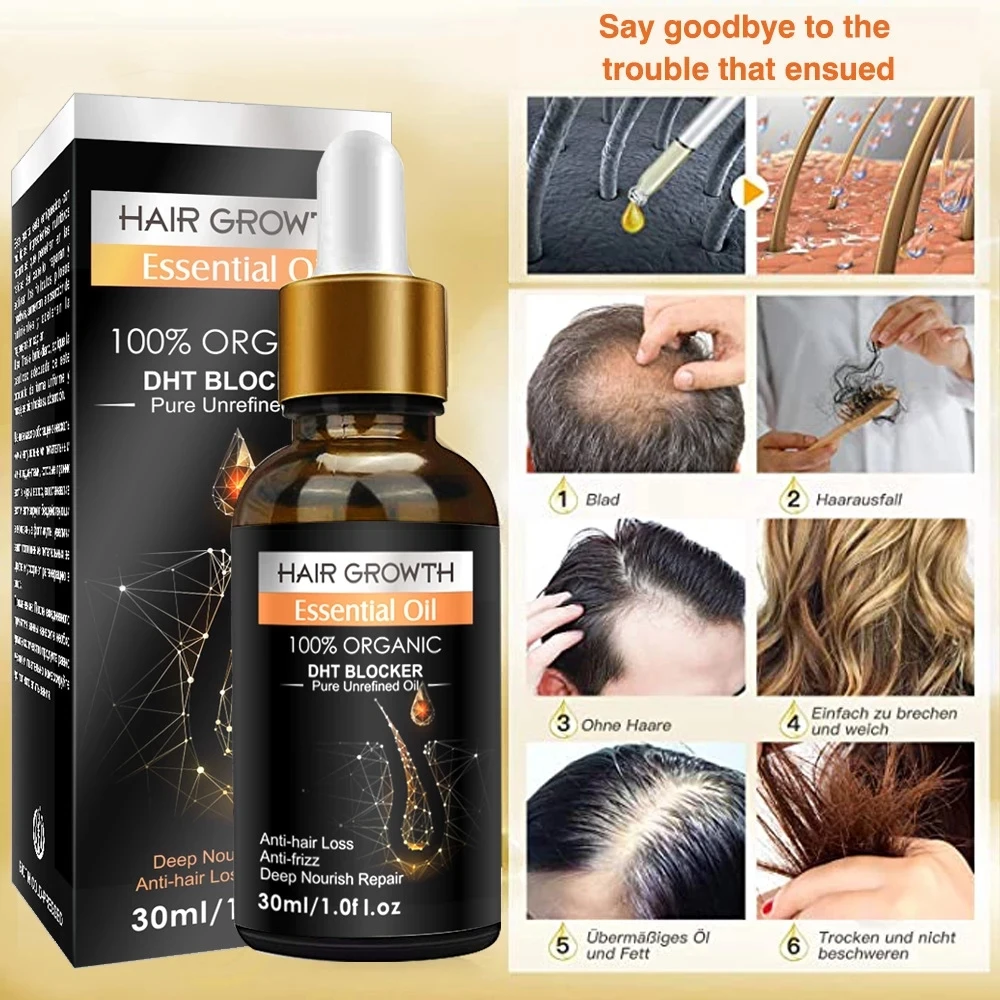 

30 мл эфирное масло для роста волос 100% органическое чистое нерафинированное масло против выпадения волос против вьющихся волос Deep питание в...