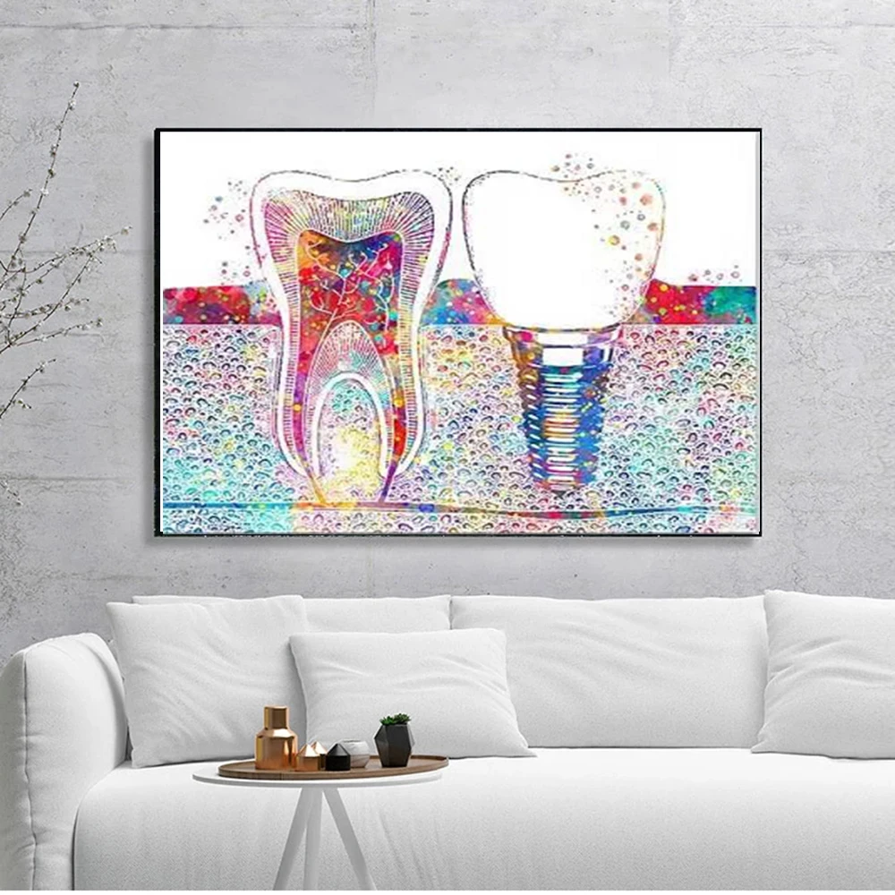 

Dental Art Posters Tooth Implant Canvas Painting Dental Hygienist Wall Prints Pictures Clinic Decor Cuadros Decoration No Frame