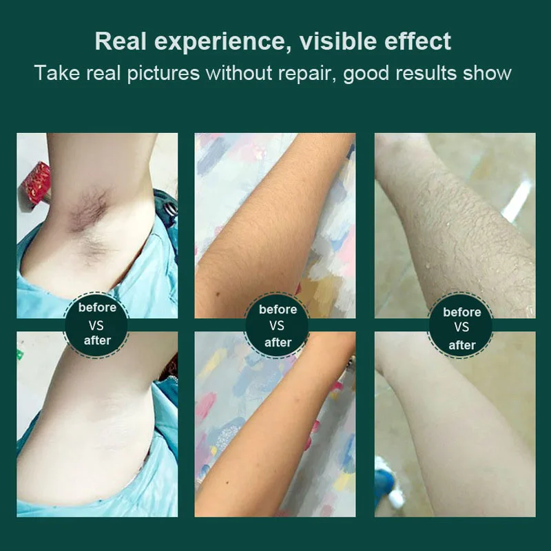 Лазерный эпилятор IPL для удаления волос на ощупь от льда Электрический депилятор