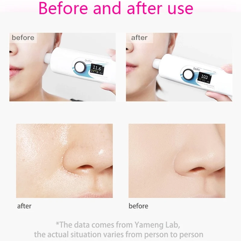 Улитка койевая кислота Осветляющий увлажняющий крем для лица и контролирует