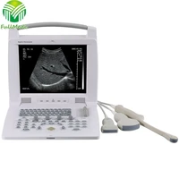fm 308i new type cheap black white full digital laptop ultrasound scanner machine with ce certificate