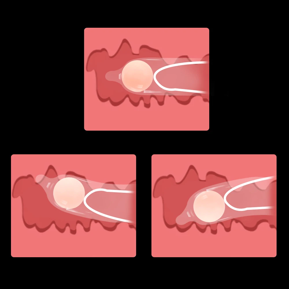 Многоразовые шариковые удлинители для пениса OLO нормальный презерватив