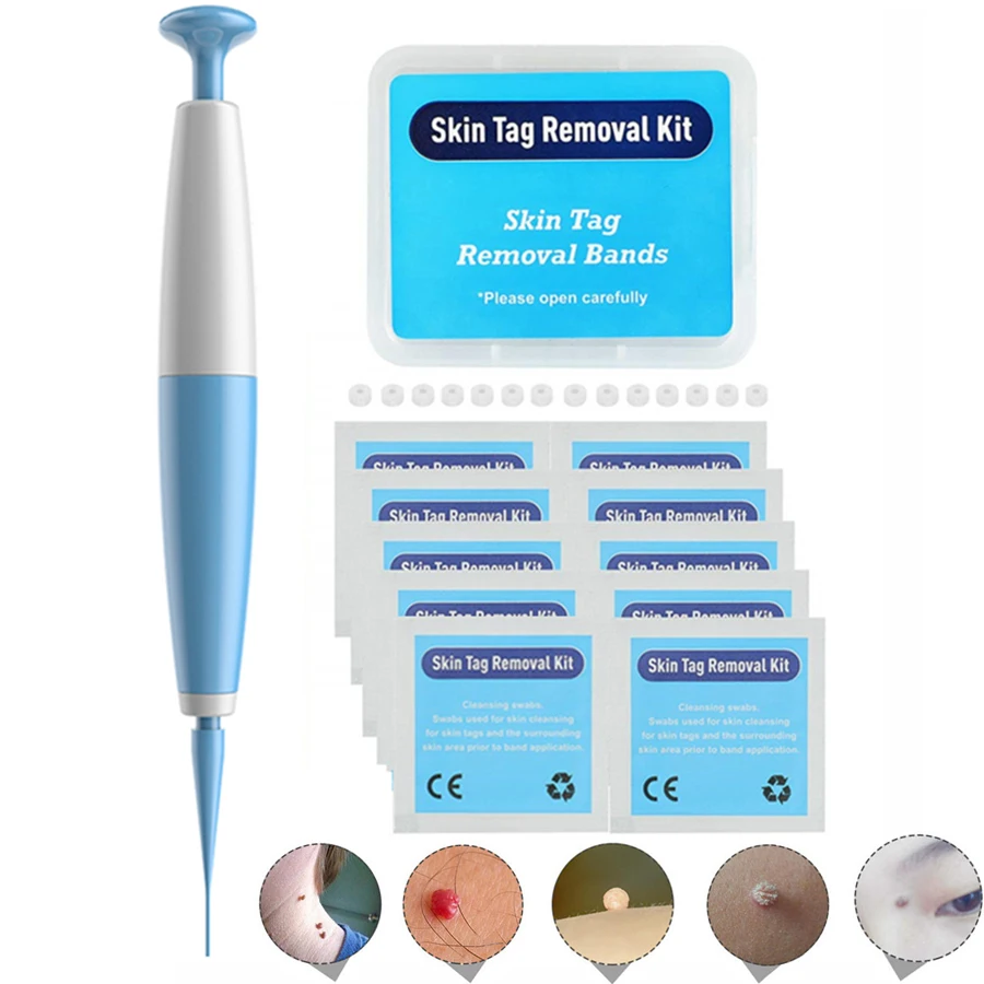 

Auto Band Non Toxic Face Care Mole Wart Tool For Small To Medium Blue Skin Tag Removal Kit With Cleansing Swabs Home Use Adult