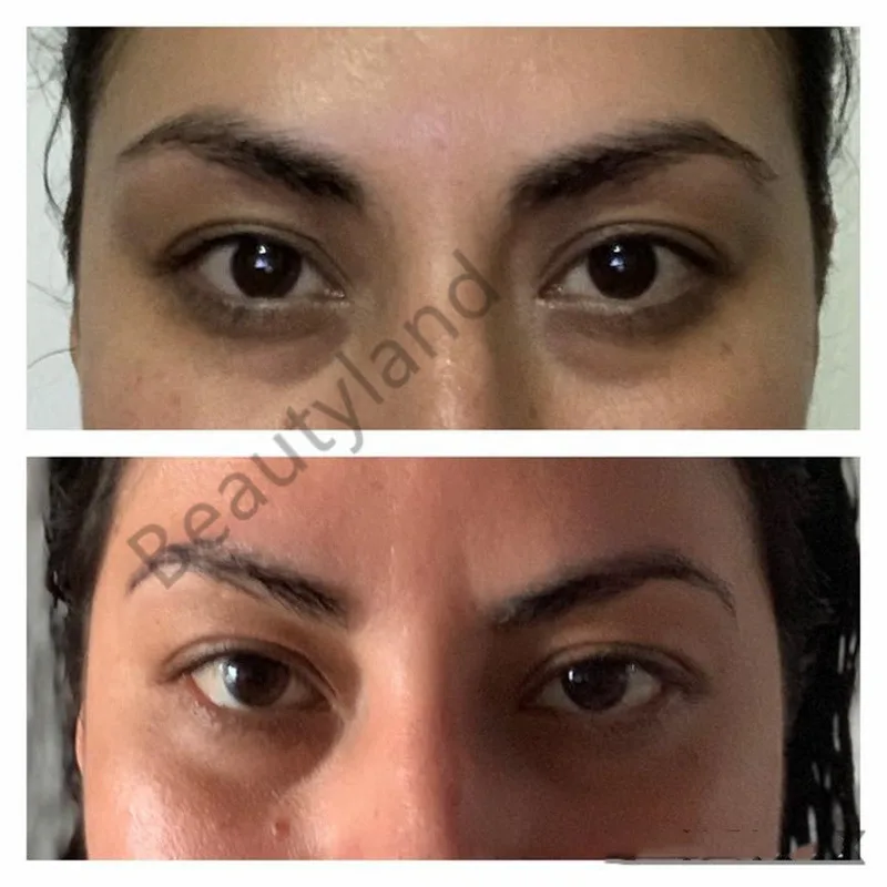 Раствор кофеина 5% + эссенция EGCG для глаз удаление темных кругов под глазами