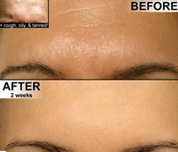 natural spf 50 face moisturizer beauty oil for skin lightening oily skin more facial creams