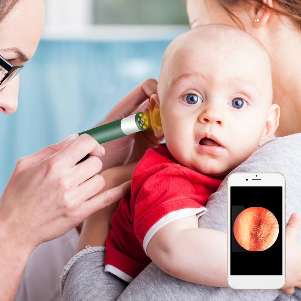 Медицинская ложка эндоскоп для чистки ушей мини камера извлечения воска