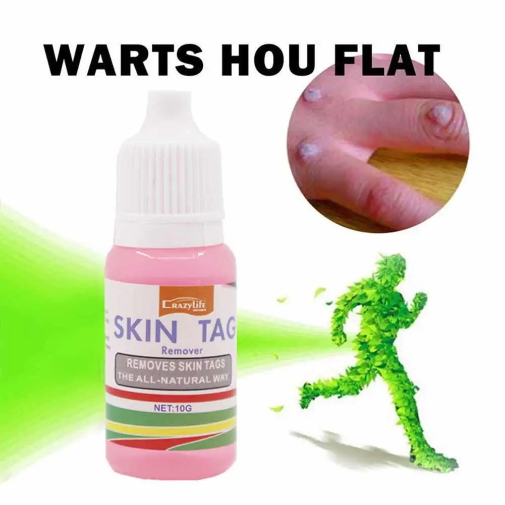 

Wart Remover Genital Wart Papillomas Removal Of Warts Liquid From Skin Tags Removing Against Moles Anti Verruca Remedy