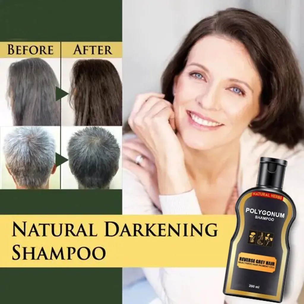 Natural Darkening Shampoo Anti-Dandruff For Anti Hair Loss Moisturizing Black Ginger Coloring | Красота и здоровье
