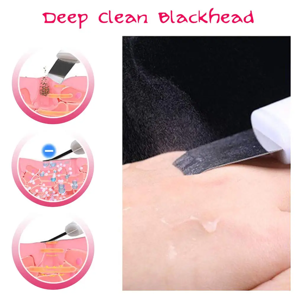 Ультразвуковой скруббер для кожи лица Вибрационный очищающий пилинг Лопата