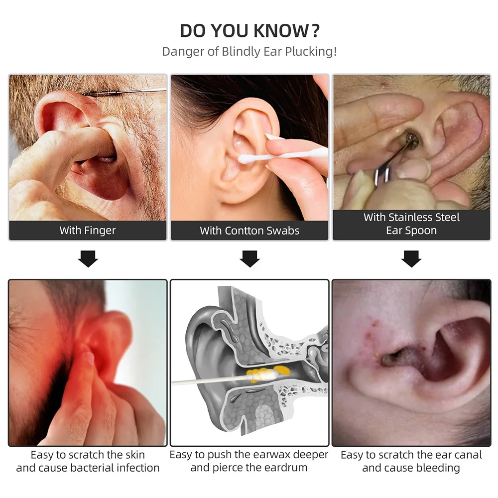 Умная Ушная камера 5 миллионов пикселей эндоскоп инструмент для чистки ушей