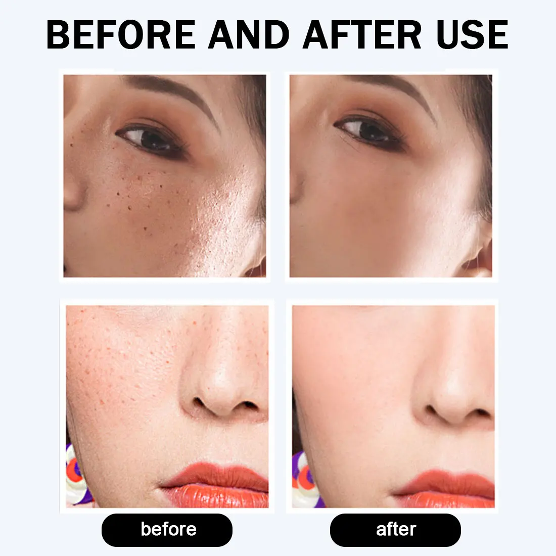 Плазменный резак избавление от веснушек удаления пера средство для бородавок