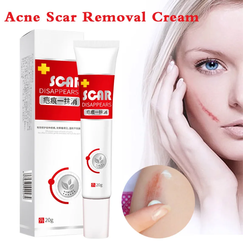 

20g Acne Scar Removal Cream For Face Scar Stretch Marks Ointment Treatment Skin Repair Skin Care Acne Spots Treatment hot sale