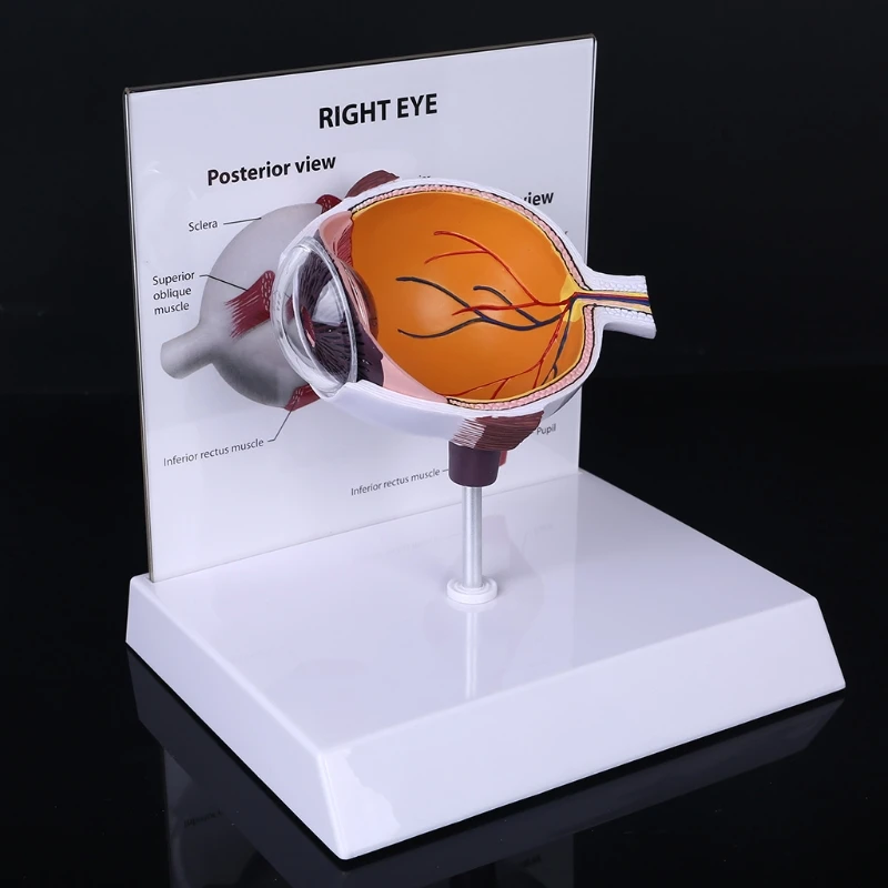 

Human Right Eye Eyeball Model Cross Section Anatomical Glaucoma Display Study Teaching Tool Retailsale