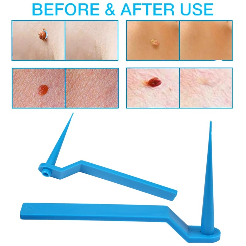 

Skin Tag Remove Patch Set Face Wart Removal Patchfor Small to Medium Skin Tag Removal Tool Kit