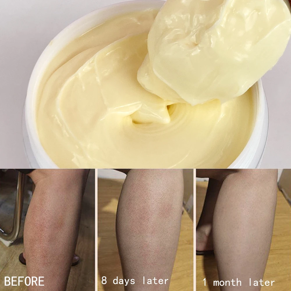 Whitening Body Cream,moisturizing And Hydrating Bleaching Face Care, Suitable Black, Brown &dark Skin