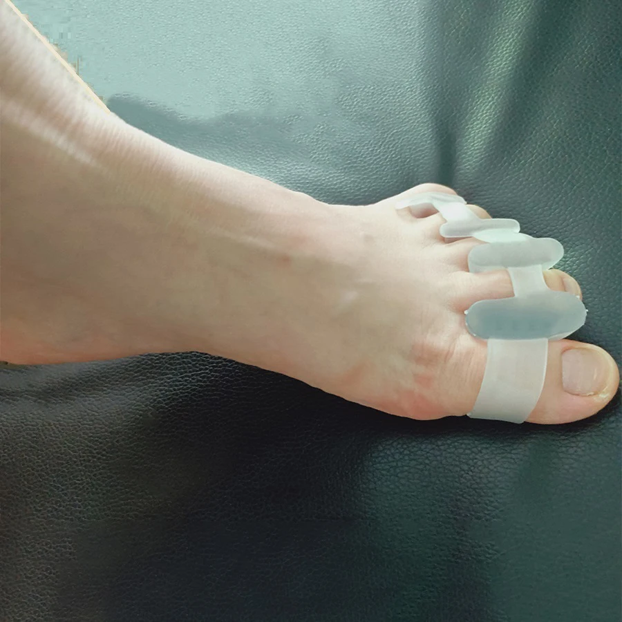 4 шт./2 упаковки ортопедические Силиконовые вставки для большого пальца ноги |