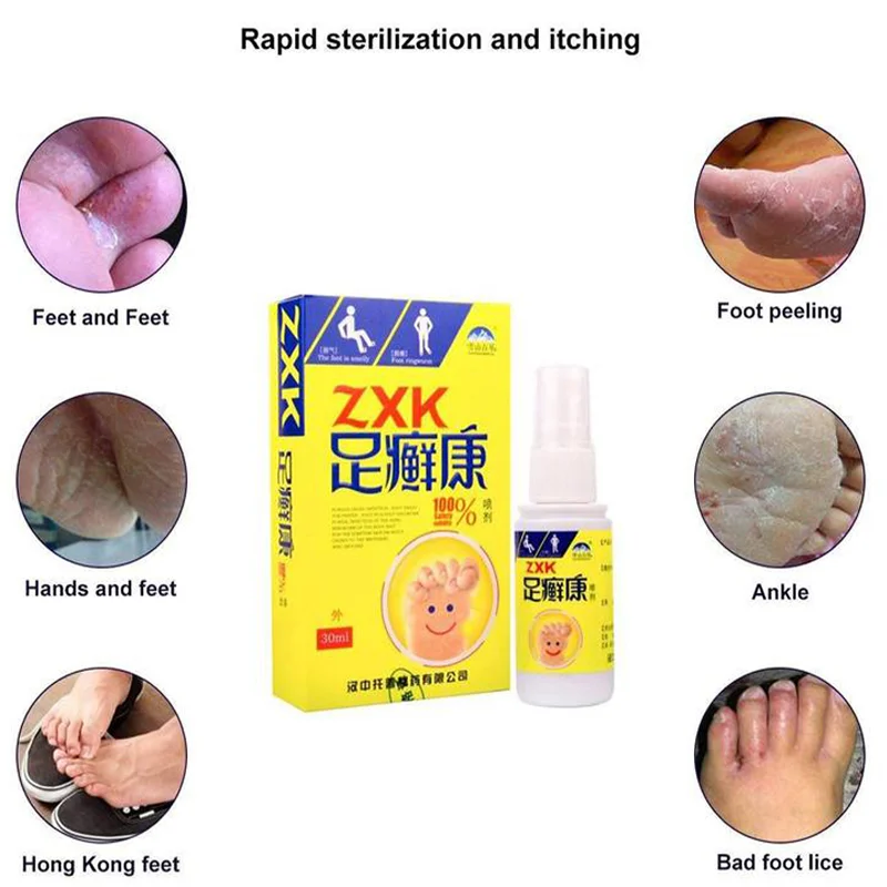 Травяной Противогрибковый спрей для ног Athlete искусственный против зуда пота