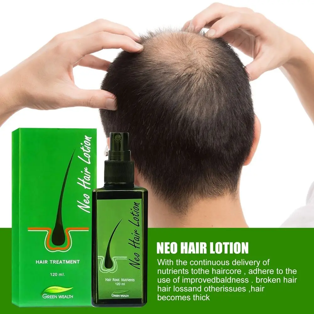 

120ML Hair Regrowth Lotion Haircare / Hair Loss Oil / Baldness Repair Spray Wash-Free Anti Hair Loss Natural Extract