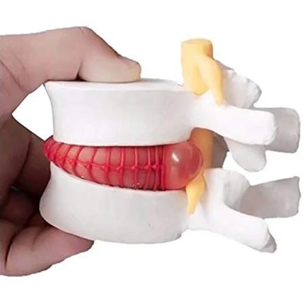 Хит 1 шт. анатомический Поясничный диск для грыжи поясничного отдела