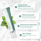 Крем для удаления шрамов и растяжек BREYLEE, восстановление и отбеливание