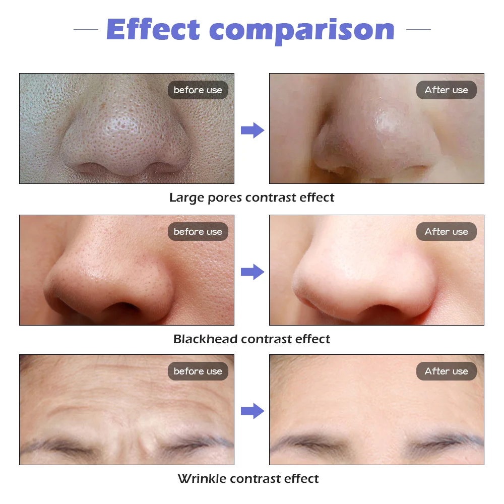 7 цветов Красота Фотон светодиодный маска для лица светильник уход за кожей