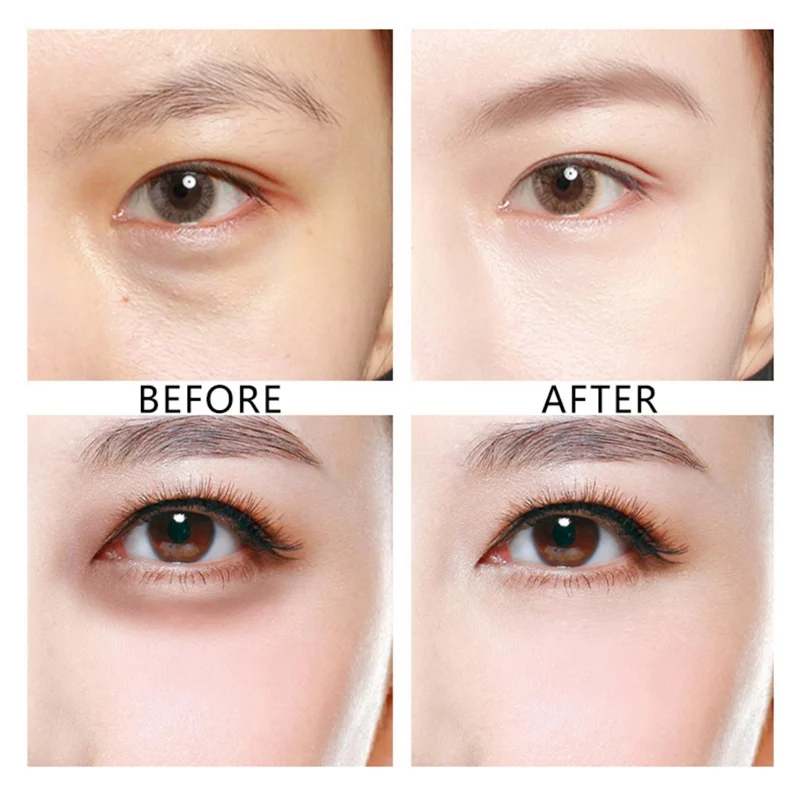 60 шт. патчи для глаз от Тёмных кругов | Красота и здоровье