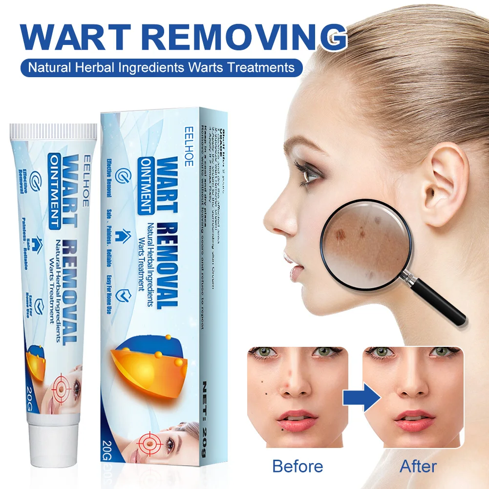 

Skin Tag Remover Cream Safe and Effective Skin Tag, Wart, Callus, Milia Remover Scar-Free Cream for Men Women Fast Delivery
