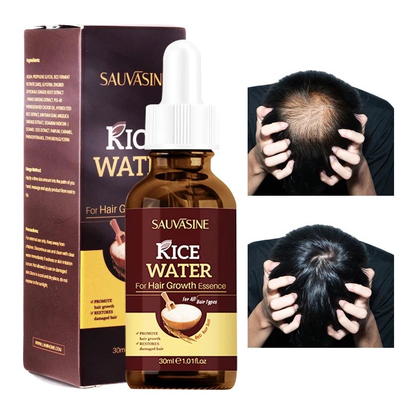 Hair Growth Serum Prevent Loss Fork Promote Regeneration Scalp Care Repair Deep Nourishment Oil Control Anti-Dandruff 30ml |