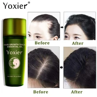 effective fast growth hair care essential moisturizing anti hair loss scalp repair anti dry anti breaking ginger scalp treatment